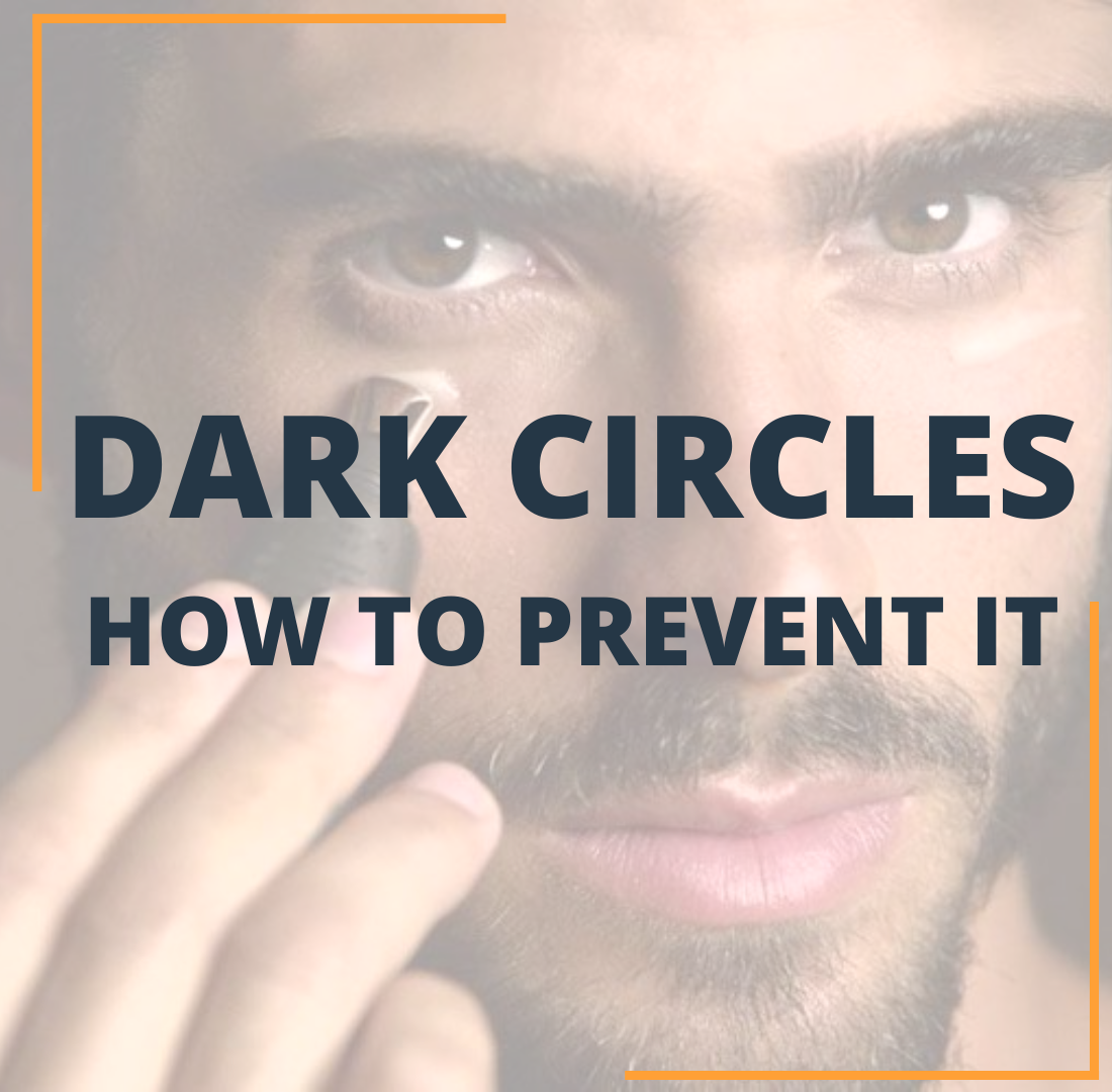 Dark Circles - How to prevent it