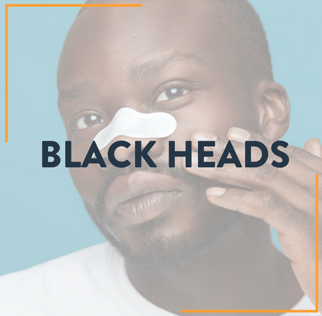 Black Heads